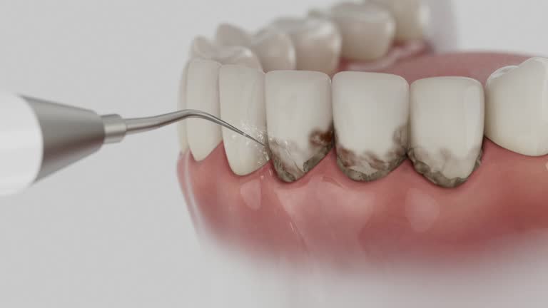 Reliable Dental Implants contractor in Marseilles, IL by Smile Center Dentistry